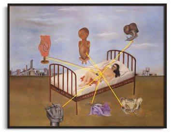 Hôpital Henry Ford - Frida Kahlo