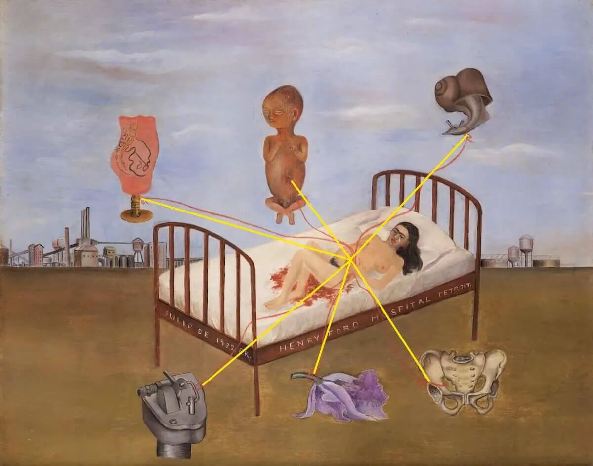 Reproduction of Henry Ford Hospital - Frida Kahlo – Galerie Mont-Blanc